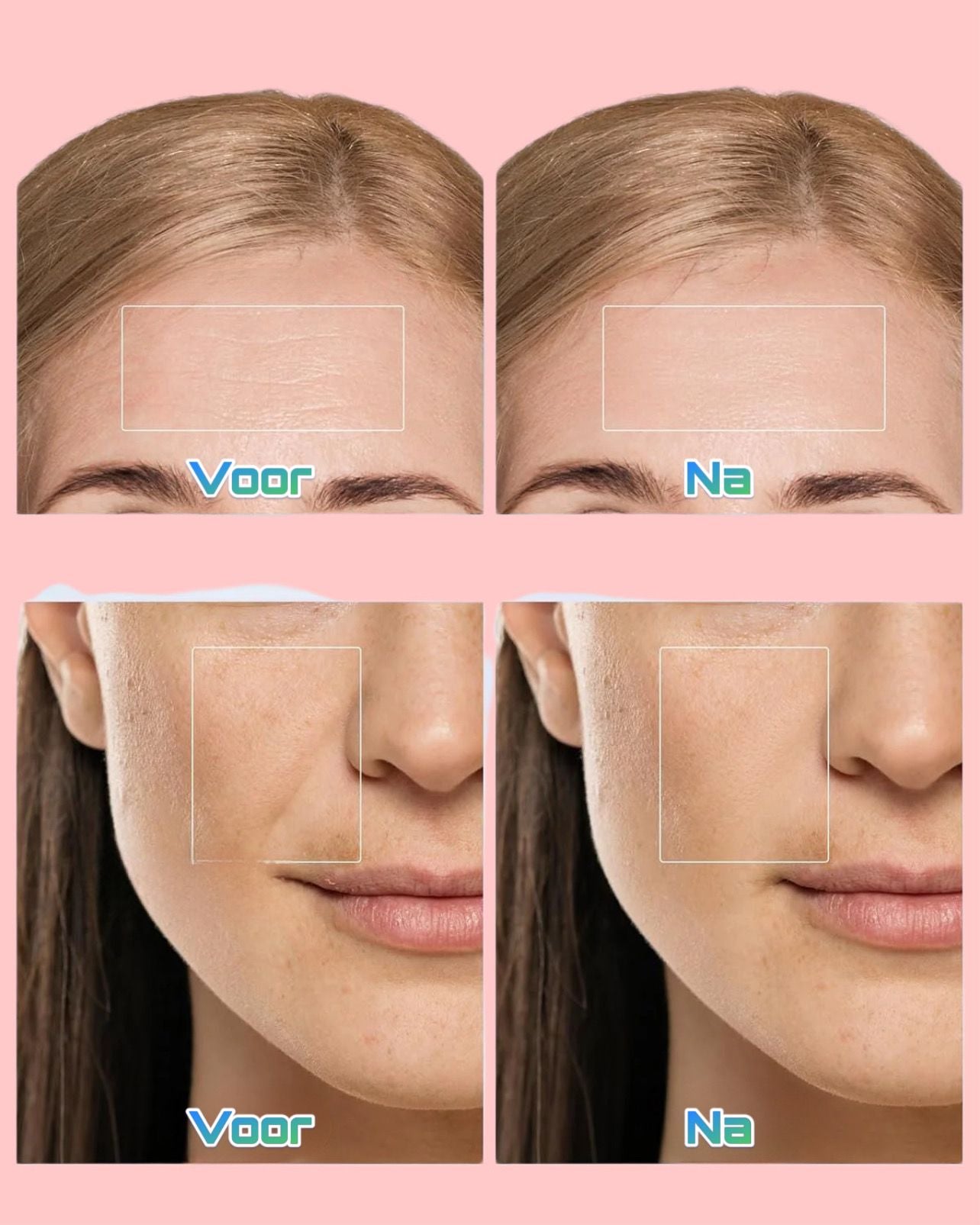 Chadé - iLED masker l Verbetert de huid met LED-Lichttherapie