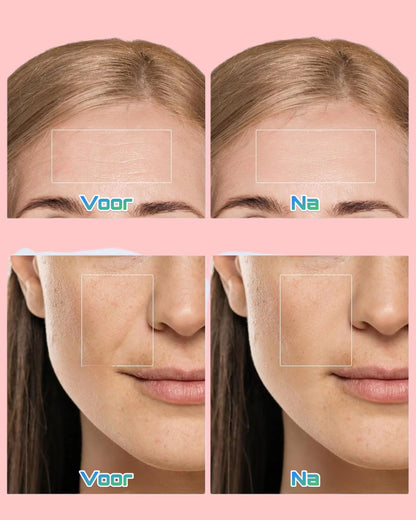 Chadé - iLED masker l Verbetert de huid met LED-Lichttherapie